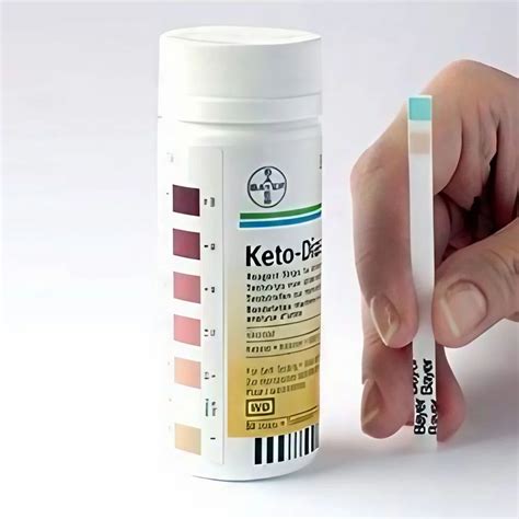 Urine Analysis Strips - Urine Analysis Test Strips Authorized Wholesale ...