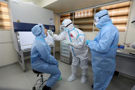 RT-PCR Test Procedure 的图像结果