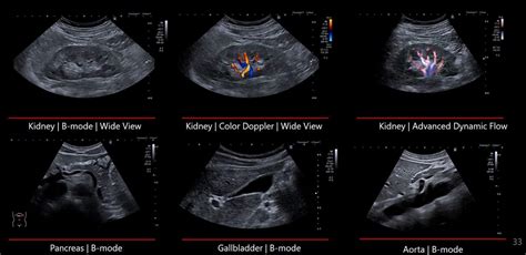 Canon Aplio go купити в Україні | InMed 2 2