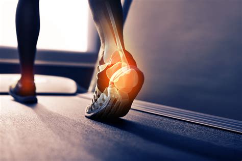 How to Deal with Ankle Pain | Cincinnati Foot & Ankle Care