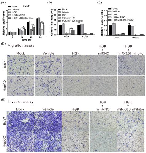 Suppression of Hepatocellular Carcinoma Progression through FOXM1 and ...