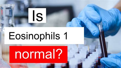 Is Eosinophils 1 normal, high or low? What does Eosinophils level 1 mean?