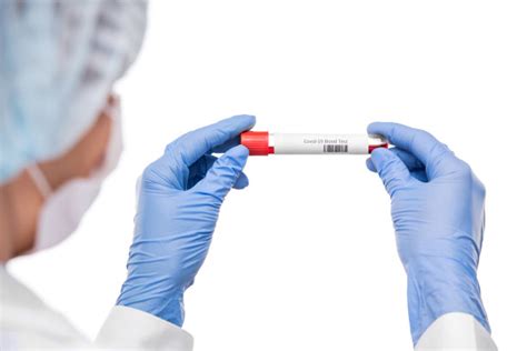 必应检验科 的图像结果