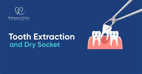 Image result for Tooth Extraction Dry Socket