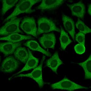 Image result for Homogeneous Pattern