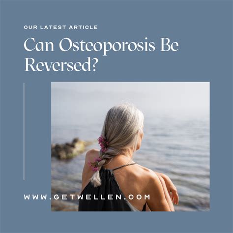 Can Osteoporosis Be Reversed? | Osteoporosis, Bone loss, Bone strengthening
