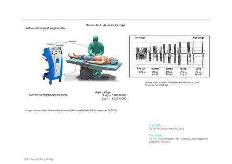 D'source Case Study - Slide Show | Design of a Surgeon Friendly ...