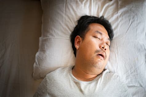 Does Sleep Apnea Go Away? | LifeMD