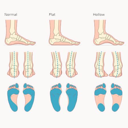 Ultimate Guide on How to choose the Perfect Footwear