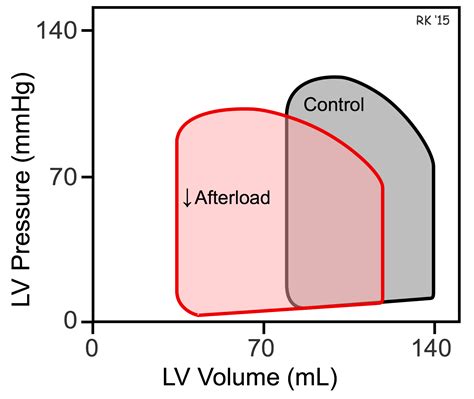 CV Physiology | Cardiac Afterload