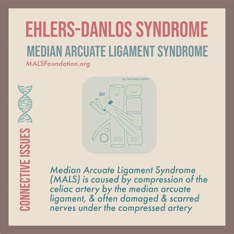 Pinterest | Ehlers danlos syndrome, Ehlers danlos syndrome symptoms, Pelvic congestion syndrome