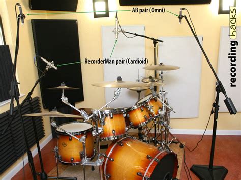 Tube SDCs on Drum Overheads | recording hacks