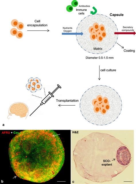 Image result for encapsulated