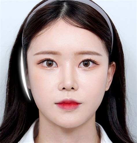 Image result for Cheekbones Reduction Book