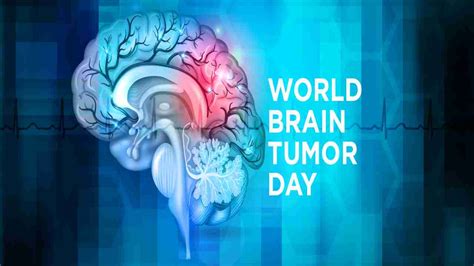 World Brain Tumor Day 2020: What is brain tumor, types, symptoms ...