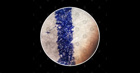 Image result for Ballpoint Pen Under Microscope