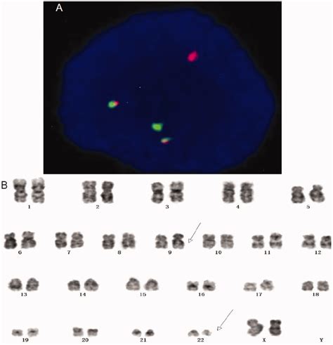 Bone Marrow Testing 的图像结果