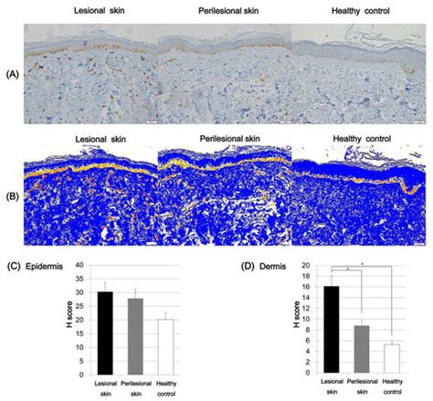Melanogenic Properties and Expression Profiles of Melanogenic Paracrine ...
