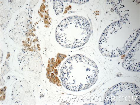 STAT1 antibody (10144-2-AP) | Proteintech