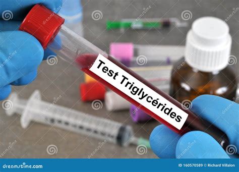 Blood Test for Triglycerides Stock Image - Image of medicine, test: 160570589