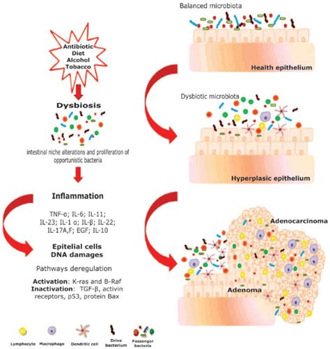 Image result for Enterococcus Faecalis Colon Cancer