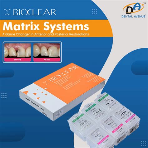 Bioclear Matrix Systems: Enhancing Dental Restorations – Dental Avenue