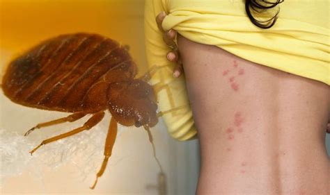 Bed bugs: Blood stains and shell casings are some of the main signs of ...