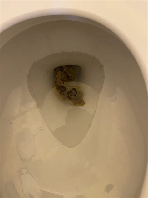 Image result for Normal Poop Images