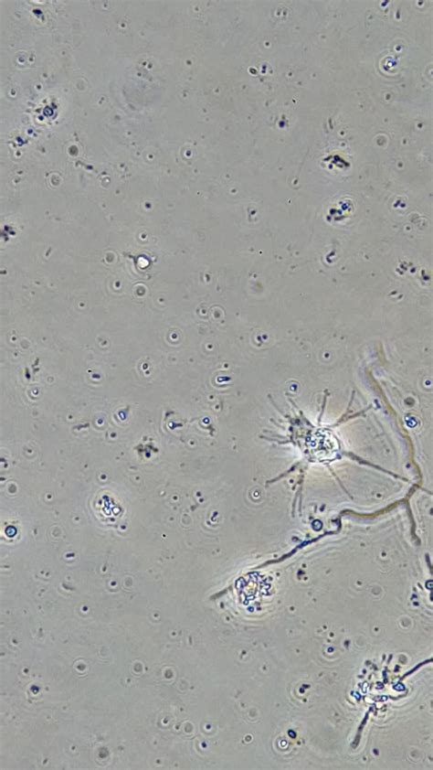 Image result for Amoeba Microscopy