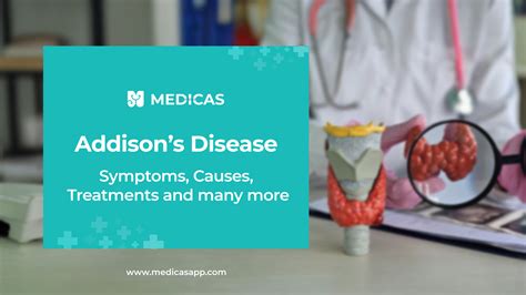 Addison's Disease: Causes, Symptoms, Treatment & Management