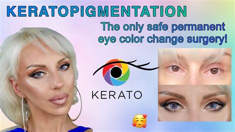 Image result for Eye Color Surgery