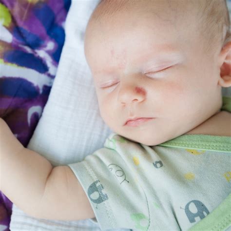 Angel Kiss Birthmark - Spiritual Meaning - Awakening State