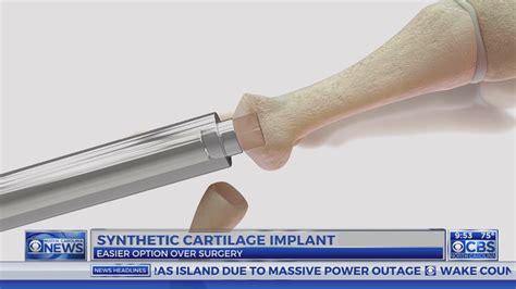 Image result for Toe Surgery