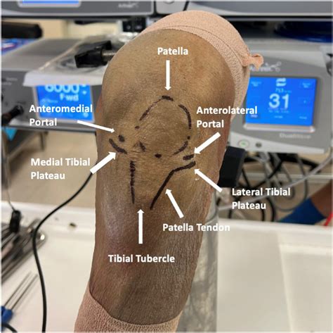 Surface Anatomy Of The Knee