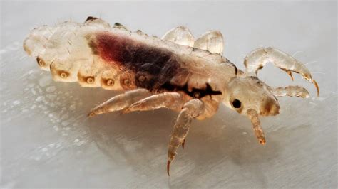 Head Lice In Spanish Translation at Bryan Polley blog
