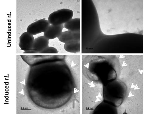 Host Pathogen Interaction Lab