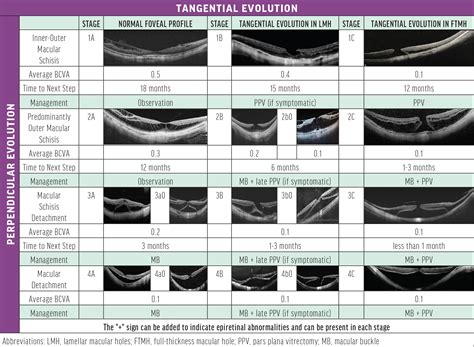 Macular Hole