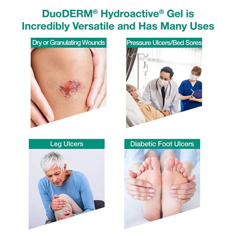 Snapklik.com : DuoDERM Hydroactive Sterile Gel, 30 Grams Tube For ...