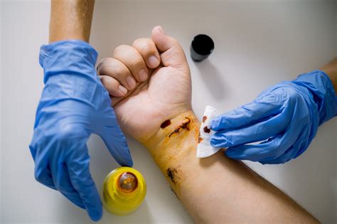 Proper Wound Cleaning and Dressing: Top First Aid Tips