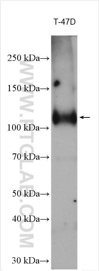 Progesterone Receptor antibody (25871-1-AP) | Proteintech