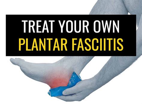 How to treat your own Plantar Fasciitis | Sports Injury Physio