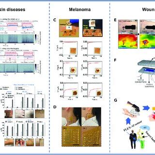 Wearable Sensor 的图像结果