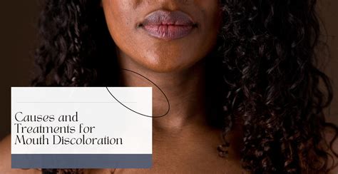 Causes and Treatments for Mouth Discoloration | Clinikally
