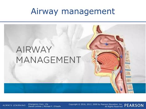 Airway Management.ppt