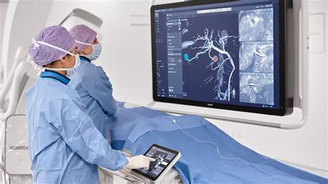Philips - SmartCT Angio - Advanced 3D visualization - Philips