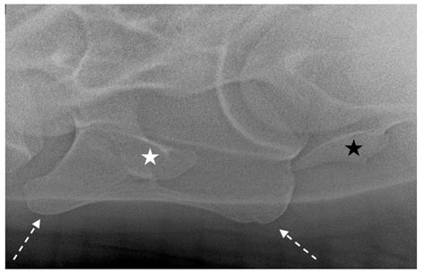 Radiological Methods for the Imaging of Congenital Malformations of C6 ...