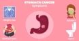 Top Reasons of Stomach Cancer | Causes & Risk Factors
