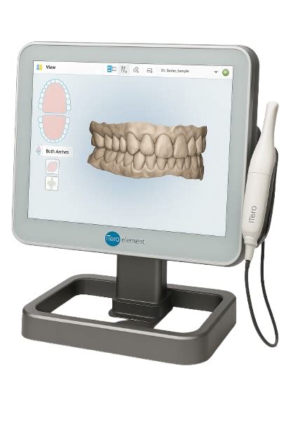 Scanner dentaire 3D en Albanie – Prix 2026 et diagnostic numérique