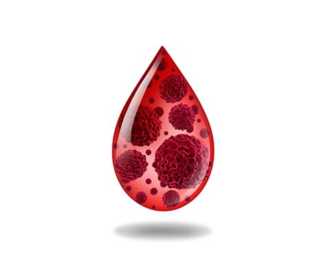 Blood and Marrow Transplantation Procedures - Cancer Treatment Centres