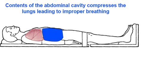 Syncope. Good or Bad?